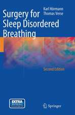 Surgery for Sleep Disordered Breathing