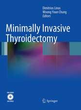 Minimally Invasive Thyroidectomy