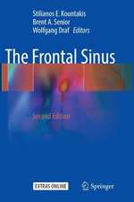 The Frontal Sinus