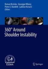 360° Around Shoulder Instability