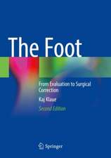 The Foot: From Evaluation to Surgical Correction