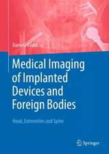 Medical Imaging of Implanted Devices and Foreign Bodies: Head, Extremities and Spine