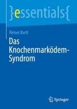 Das Knochenmarködem-Syndrom: Fortschritte in Diagnose und Therapie