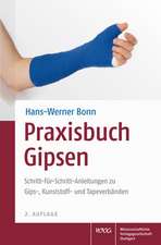 Praxisbuch Gipsen