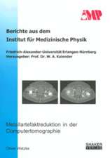 Metallartefaktreduktion in der Computertomographie