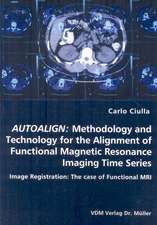 Autoalign: Methodology and Technology for the Alignment of Functional Magnetic Resonance Imaging Time Series: Image Registration: The Case of Functional MRI