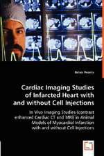 Cardiac Imaging Studies of Infarcted Heart with and without Cell Injections