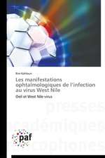 Les manifestations ophtalmologiques de l¿infection au virus West Nile