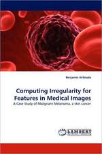 Computing Irregularity for Features in Medical Images