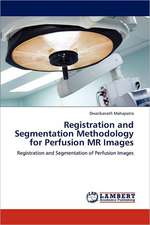 Registration and Segmentation Methodology for Perfusion MR Images