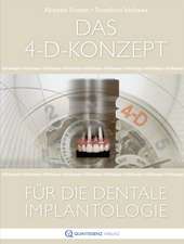 Das 4-D-Konzept für die dentale Implantologie