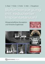 Sofortversorgung mit reduzierter Implantatanzahl