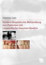 Kieferorthopädische Behandlung von Patienten mit Lippen-Kiefer-Gaumen-Spalten