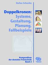 Doppelkronen: Systeme, Gestaltung, Planung, Fallbeispiele