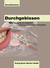 Durchgebissen