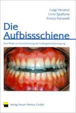 Die Aufbissschiene