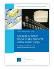 Allogene Knochenblöcke in der zahnärztlichen Implantologie