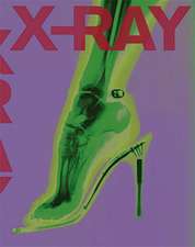 X-RAY