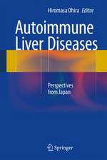 Autoimmune Liver Diseases: Perspectives from Japan