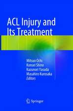 ACL Injury and Its Treatment