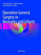 Operative General Surgery in Neonates and Infants