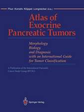 Atlas of Exocrine Pancreatic Tumors: Morphology, Biology, and Diagnosis with an International Guide for Tumor Classification