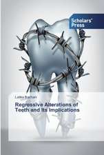 Regressive Alterations of Teeth and Its Implications