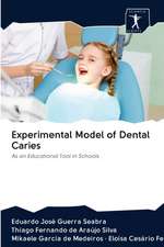 Experimental Model of Dental Caries