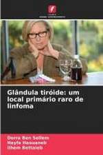 Glândula tiróide: um local primário raro de linfoma