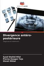 Divergence antéro-postérieure