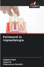 Fallimenti in implantologia