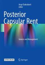 Posterior Capsular Rent: Genesis and Management