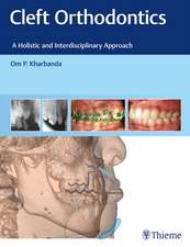 Cleft Orthodontics – A Holistic and Interdisciplinary Approach