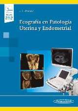 Ecografía en Patología Uterina y Endometrial