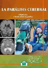 La parálisis cerebral : diagnóstico e intervención logopédica