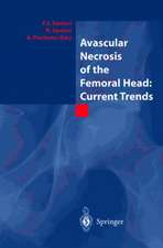 Avascular Necrosis of the Femoral Head: Current Trends: Current Trends