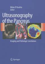 Ultrasonography of the Pancreas: Imaging and Pathologic Correlations