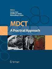 MDCT: A Practical Approach