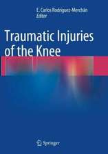 Traumatic Injuries of the Knee