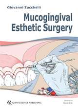 Mucogingival Esthetic Surgery