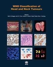 WHO Classification of Head and Neck Tumours