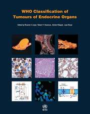 Who Classification of Tumours of Endocrine Organs