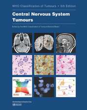 Central Nervous System Tumours