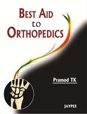 Best Aid to Orthopedics