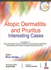 Atopic Dermatitis and Pruritus: Interesting Cases