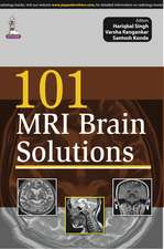 101 MRI Brain Solutions