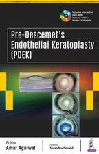 Pre-Descemet’s Endothelial Keratoplasty (PDEK)