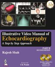 Illustrative Video Manual of Echocardiography Part 2: A Step by Step Approach