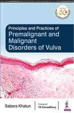 Principles and Practice of Premalignant and Malignant Disorders of Vulva