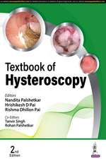 Textbook of Hysteroscopy